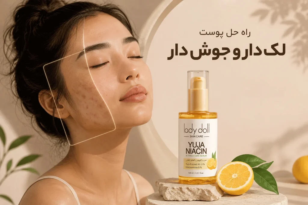 پوست لک دار و جوش دار