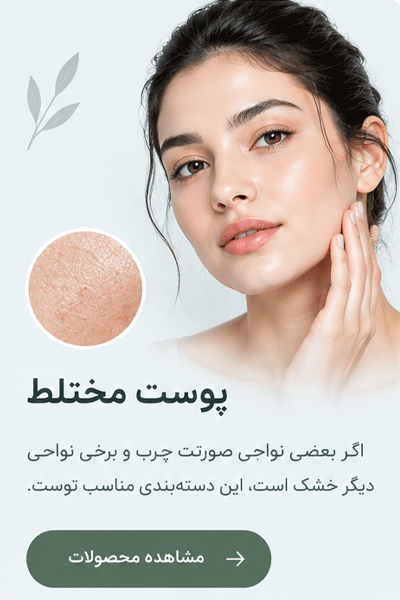 لندینگ پوست