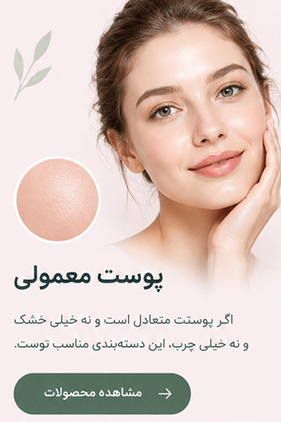 لندینگ پوست