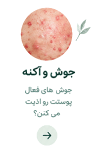 لندینگ پوست