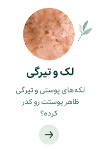 لندینگ پوست