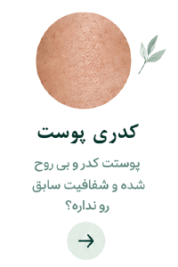 لندینگ پوست
